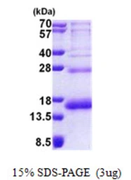Human RPS19 protein, His tag. GTX67783-pro