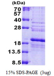 Human RPS24 protein, His tag. GTX67785-pro