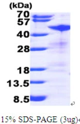 Human RRM2 protein, His tag. GTX67786-pro