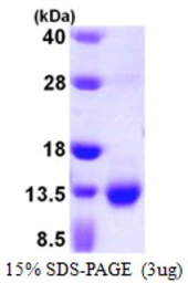 Human S100A3 protein, His tag. GTX67788-pro
