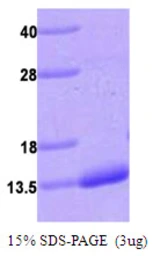 Human S100A4 protein, His tag. GTX67789-pro