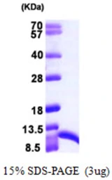 Human S100A6 protein, His tag. GTX67791-pro