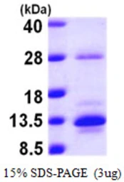 Human S100A10 protein, His tag. GTX67796-pro