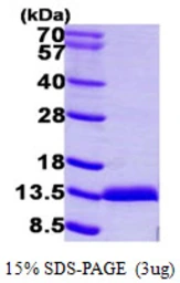 Human S100A11 protein, His tag. GTX67797-pro
