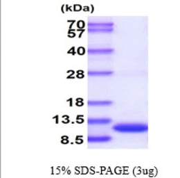 Human S100 beta protein, His tag. GTX67799-pro
