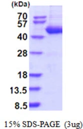 Human SERPINB4 protein, His tag. GTX67806-pro