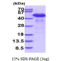 Human SET protein, His tag. GTX67811-pro