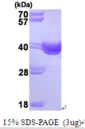 Human SGTA protein, His tag. GTX67814-pro