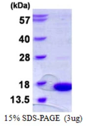 Human SH3BGRL protein, His tag. GTX67815-pro