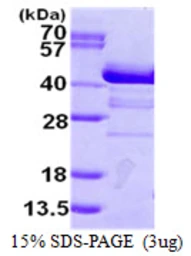 Human SH3GL2 protein, His tag. GTX67816-pro