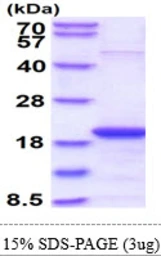 Human SKP1 protein. GTX67821-pro