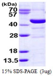 Human Spermine synthase protein, His tag. GTX67823-pro