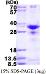 Human SNRPA1 protein, His tag. GTX67837-pro