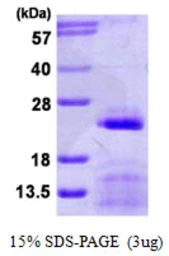 Human SNRPC protein, His tag. GTX67839-pro