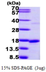 Human SNRPD2 protein, His tag. GTX67840-pro
