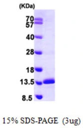Human SNRPE protein, His tag. GTX67842-pro