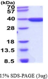 Human AKR1D1 protein. GTX67850-pro