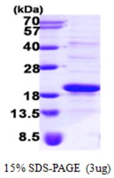 Human SRP14 protein, His tag. GTX67852-pro