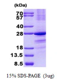 Human SSX1 protein, His tag. GTX67854-pro