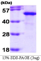 Human HIP protein. GTX67855-pro