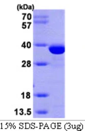Human Estrogen Sulfotransferase protein, His tag. GTX67858-pro