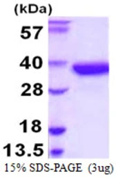 Human SULT1A2 protein, His tag. GTX67861-pro