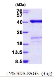 Human SURF2 protein, His tag. GTX67866-pro