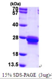 Human Transgelin protein, His tag. GTX67867-pro