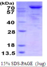 Human ThrRS protein, His tag. GTX67870-pro