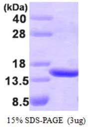 Human TBCA protein. GTX67871-pro