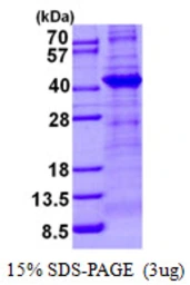 Human TBCC protein, His tag. GTX67872-pro