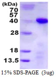 Human TCEA1 protein, His tag. GTX67873-pro