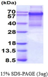 Human TCF4 protein, His tag. GTX67877-pro