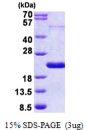 Human THRSP protein, His tag. GTX67886-pro