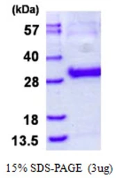 Human Thymidine Kinase 1 protein, His tag. GTX67888-pro