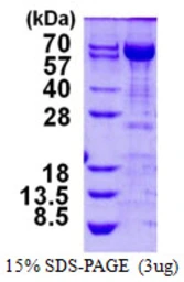 Human Transketolase protein, His tag. GTX67889-pro