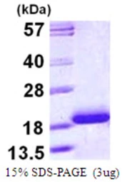 Human Cardiac Troponin C protein, His tag. GTX67891-pro