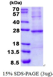 Human Troponin I fast skeletal muscle protein, His tag. GTX67893-pro