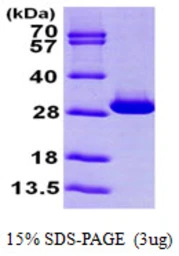 Human Triosephosphate isomerase protein, His tag. GTX67896-pro