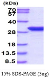 Human TPMT protein. GTX67901-pro