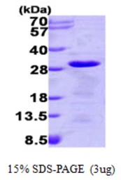 Human TCTP protein, His tag. GTX67902-pro