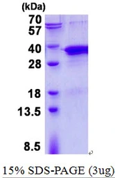 Human TRAX protein, His tag. GTX67904-pro