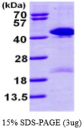 Human TSTA3 protein, His tag. GTX67907-pro