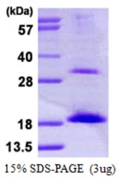 Human UBE2D3 protein, His tag. GTX67918-pro