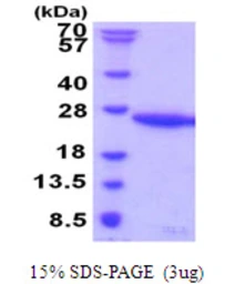 Human UBE2G1 protein, His tag. GTX67920-pro