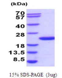 Human UBE2G2 protein, His tag. GTX67921-pro