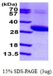 Human UCK2 protein, His tag. GTX67929-pro
