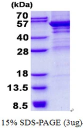 Human UMPS protein, His tag. GTX67930-pro