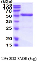 Human UMPS protein, His tag. GTX67931-pro