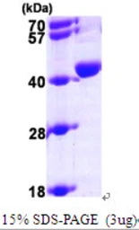 Human UROD protein, His tag. GTX67933-pro
